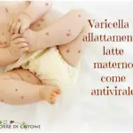 Varicella e allattamento: latte materno come antivirale